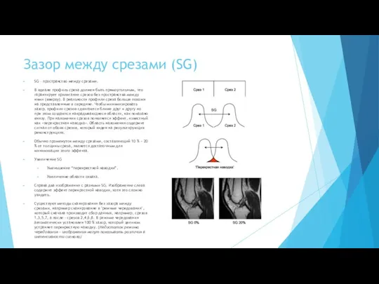 Зазор между срезами (SG) SG - пространство между срезами. В