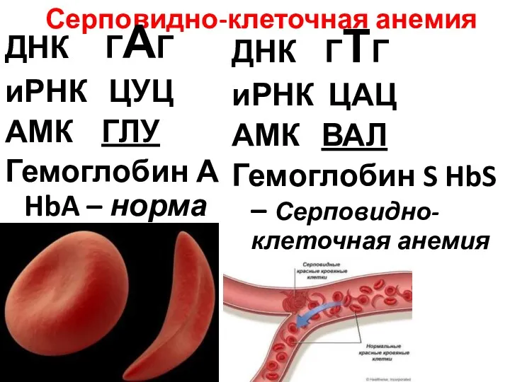 Серповидно-клеточная анемия ДНК ГАГ иРНК ЦУЦ АМК ГЛУ Гемоглобин А