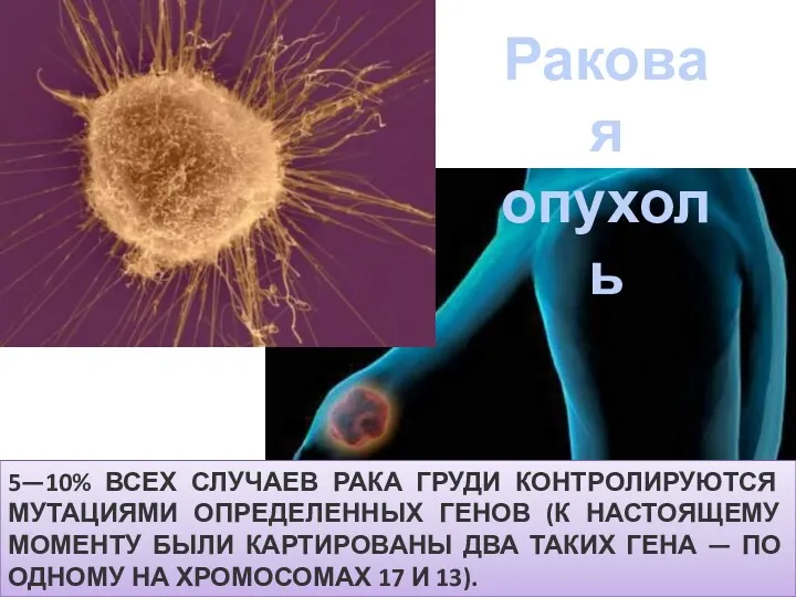 Раковая опухоль 5—10% ВСЕХ СЛУЧАЕВ РАКА ГРУДИ КОНТРОЛИРУЮТСЯ МУТАЦИЯМИ ОПРЕДЕЛЕННЫХ