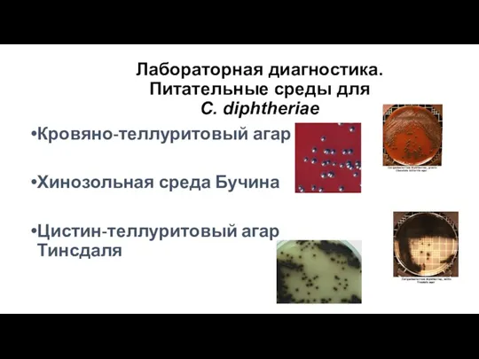 Лабораторная диагностика. Питательные среды для C. diphtheriae Кровяно-теллуритовый агар Хинозольная среда Бучина Цистин-теллуритовый агар Тинсдаля
