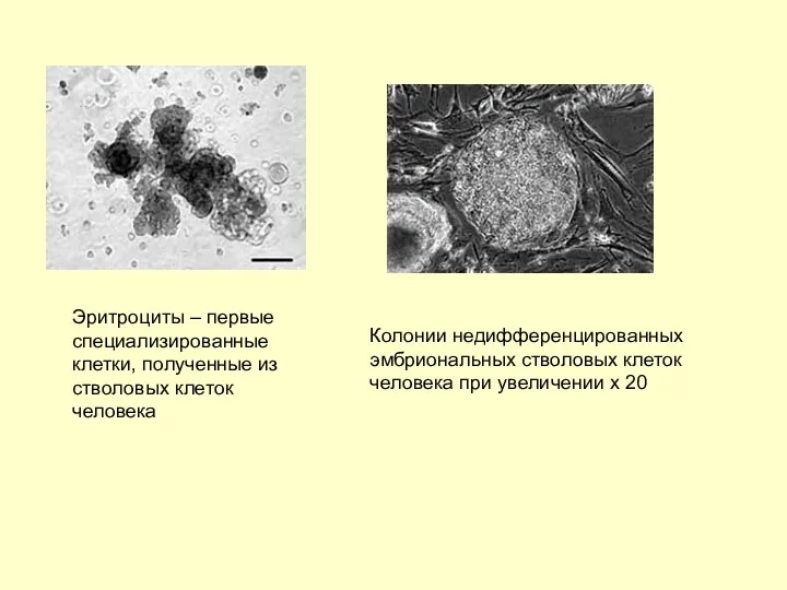 Эритроциты – первые специализированные клетки, полученные из стволовых клеток человека Колонии недифференцированных эмбриональных