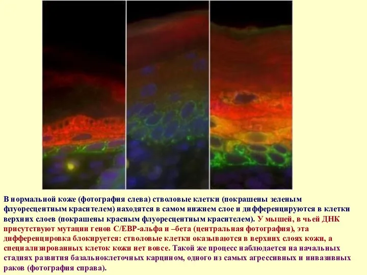 В нормальной коже (фотография слева) стволовые клетки (покрашены зеленым флуоресцентным красителем) находятся в