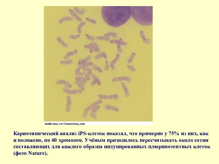 Кариотипический анализ iPS-клеток показал, что примерно у 75% из них, как и положено,