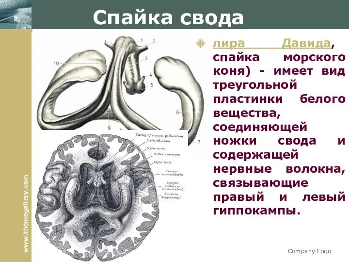 Спайка свода лира Давида, спайка морского коня) - имеет вид