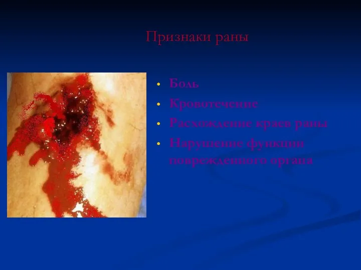 Признаки раны Боль Кровотечение Расхождение краев раны Нарушение функции поврежденного органа