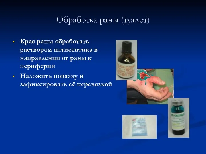 Обработка раны (туалет) Края раны обработать раствором антисептика в направлении от раны к