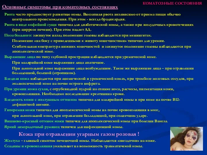 КОМАТОЗНЫЕ СОСТОЯНИЯ Рвота часто предшествует развитию комы. Внезапная рвота независимо