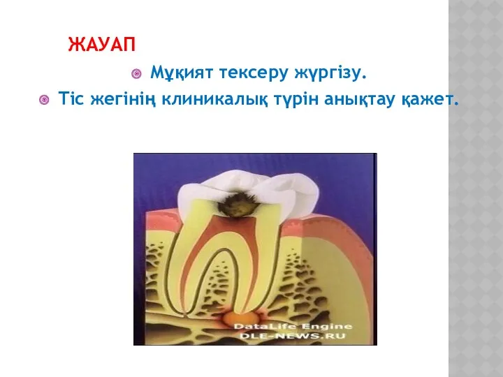 ЖАУАП Мұқият тексеру жүргізу. Тіс жегінің клиникалық түрін анықтау қажет.