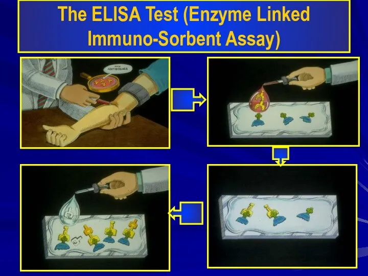 The ELISA Test (Enzyme Linked Immuno-Sorbent Assay)