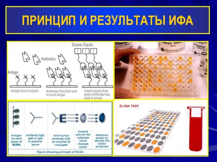 ПРИНЦИП И РЕЗУЛЬТАТЫ ИФА