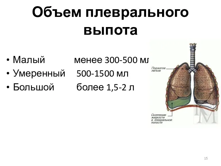 Объем плеврального выпота Малый менее 300-500 мл Умеренный 500-1500 мл Большой более 1,5-2 л