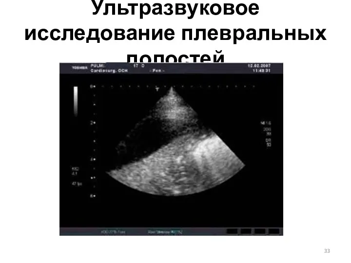 Ультразвуковое исследование плевральных полостей