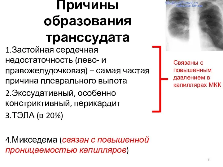 Причины образования транссудата 1.Застойная сердечная недостаточность (лево- и правожелудочковая) –