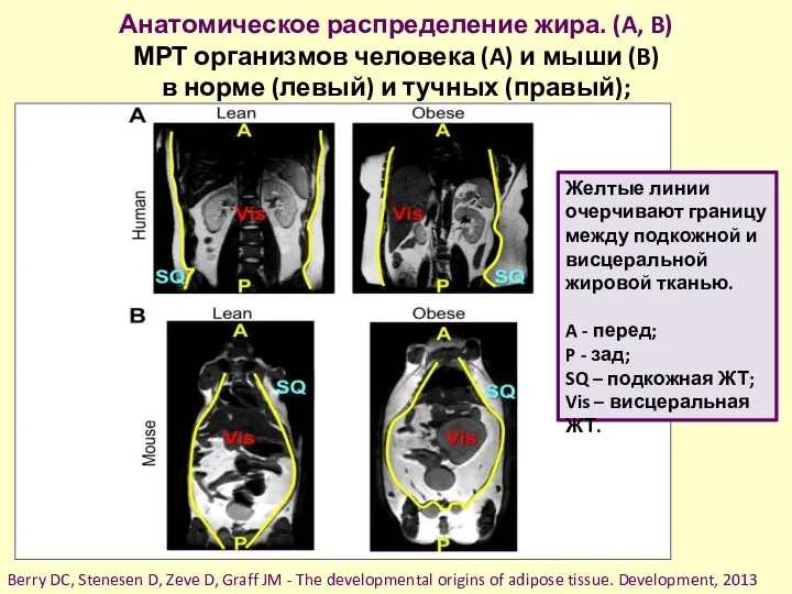 Анатомическое распределение жира. (A, B) МРТ организмов человека (A) и