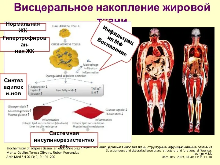 Висцеральное накопление жировой ткани Подкожная и висцеральная жировая ткань: структурные