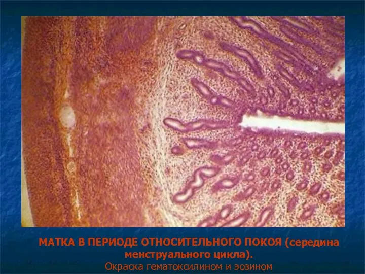 МАТКА В ПЕРИОДЕ ОТНОСИТЕЛЬНОГО ПОКОЯ (середина менструального цикла). Окраска гематоксилином и эозином
