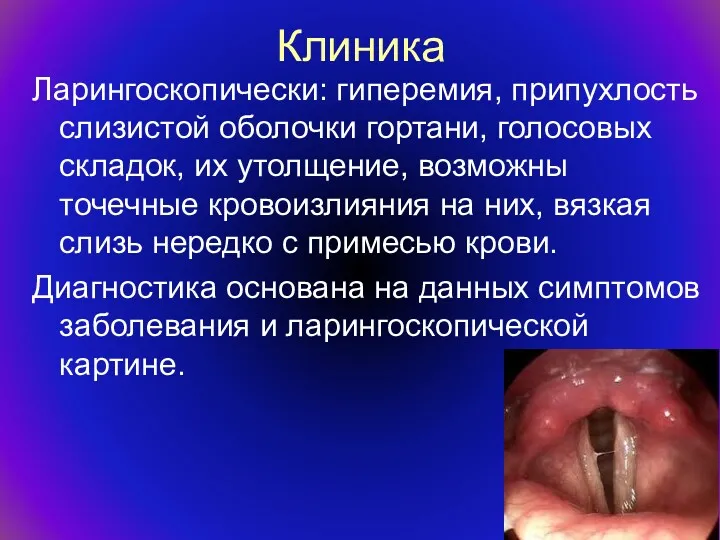 Клиника Ларингоскопически: гиперемия, припухлость слизистой оболочки гортани, голосовых складок, их