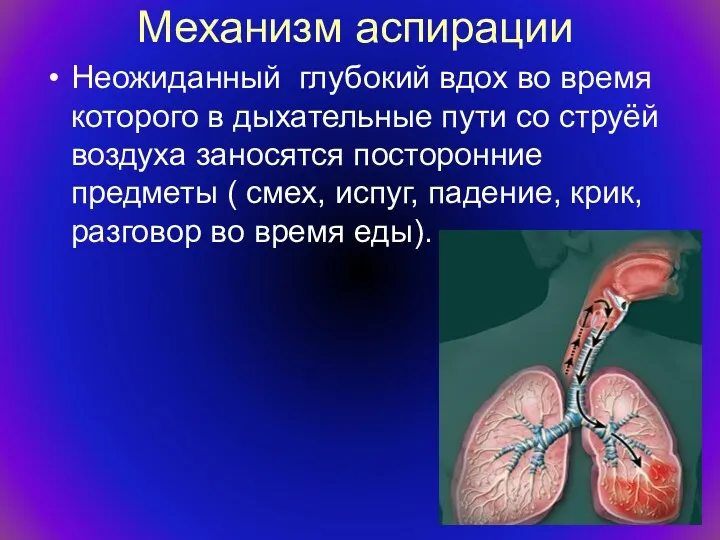 Механизм аспирации Неожиданный глубокий вдох во время которого в дыхательные пути со струёй