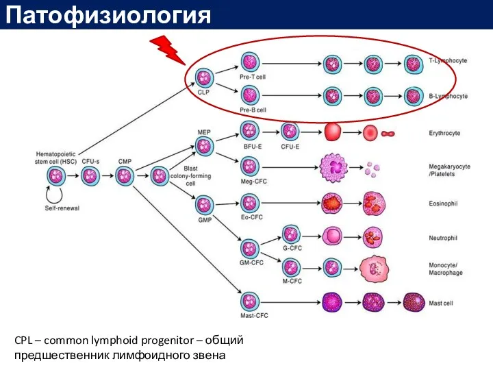 Патофизиология CPL – common lymphoid progenitor – общий предшественник лимфоидного звена