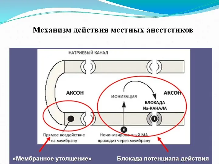 Механизм действия местных анестетиков