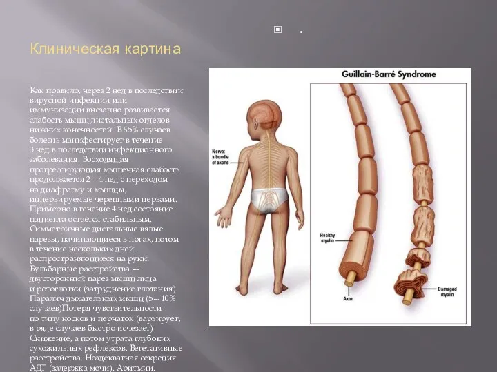 Клиническая картина Как правило, через 2 нед в последствии вирусной