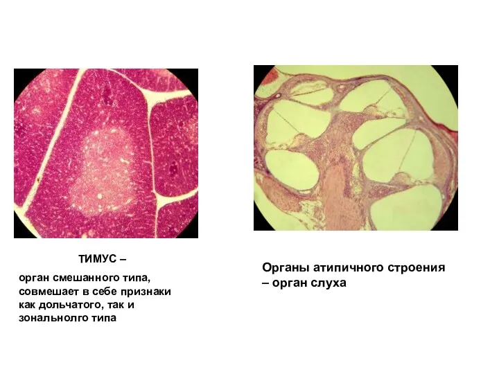 ТИМУС – орган смешанного типа, совмешает в себе признаки как