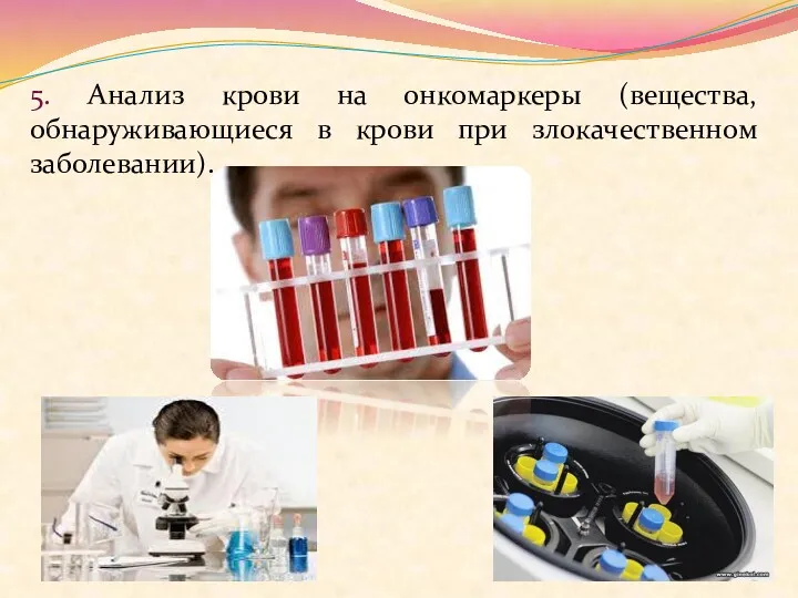 5. Анализ крови на онкомаркеры (вещества, обнаруживающиеся в крови при злокачественном заболевании).