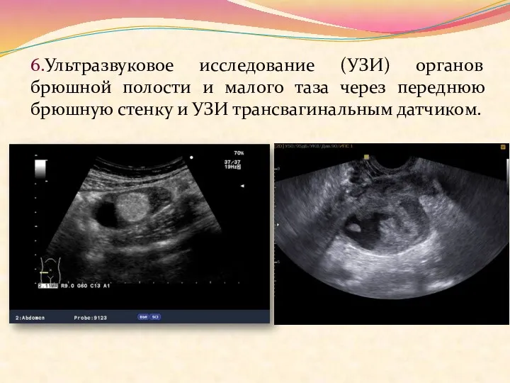 6.Ультразвуковое исследование (УЗИ) органов брюшной полости и малого таза через