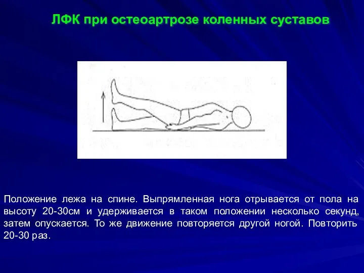 ЛФК при остеоартрозе коленных суставов Положение лежа на спине. Выпрямленная