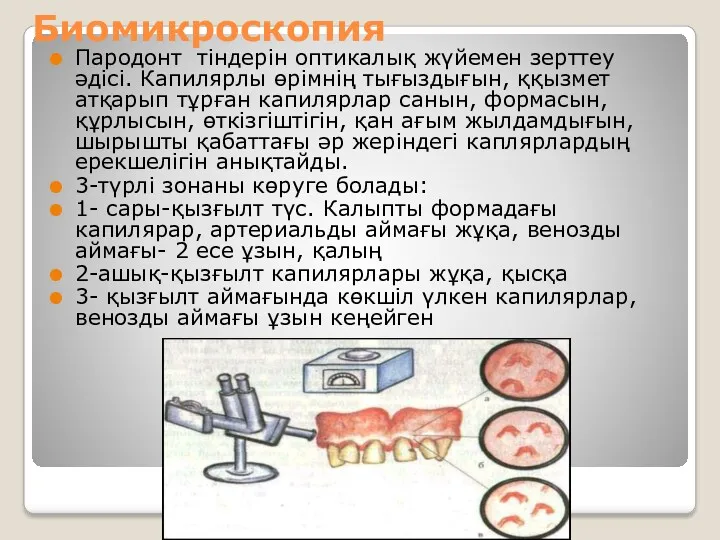 Биомикроскопия Пародонт тіндерін оптикалық жүйемен зерттеу әдісі. Капилярлы өрімнің тығыздығын, ққызмет атқарып тұрған