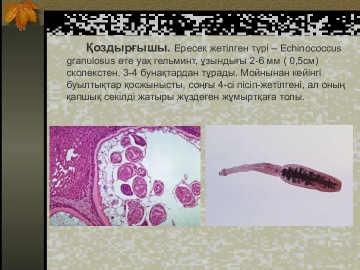 Қоздырғышы. Ересек жетілген түрі – Echinococcus granulosus өте уақ гельминт, ұзындығы 2-6 мм