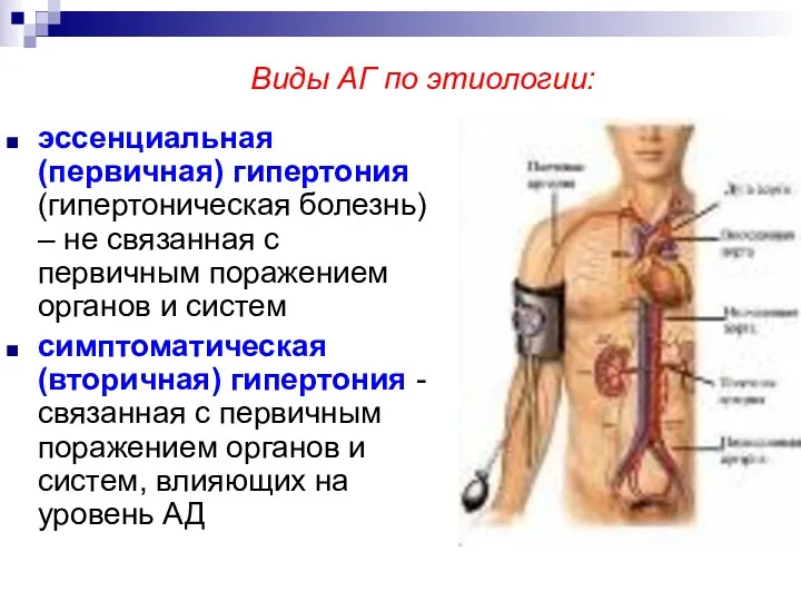 Виды АГ по этиологии: эссенциальная (первичная) гипертония (гипертоническая болезнь) –