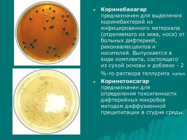 Коринебакагар предназначен для выделения коринебактерий из инфицированного материала (отделяемого из