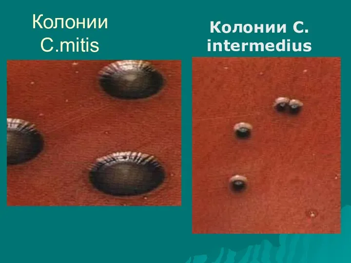 Колонии C.mitis Колонии C. intermedius