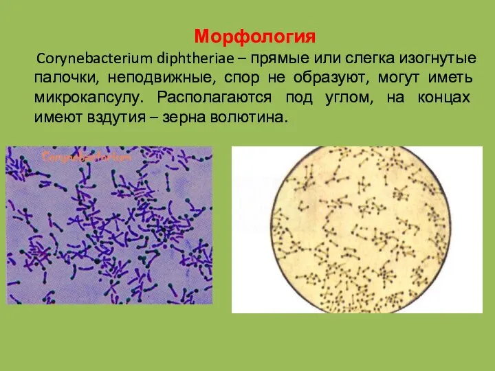 Морфология Corynebacterium diphtheriae – прямые или слегка изогнутые палочки, неподвижные,