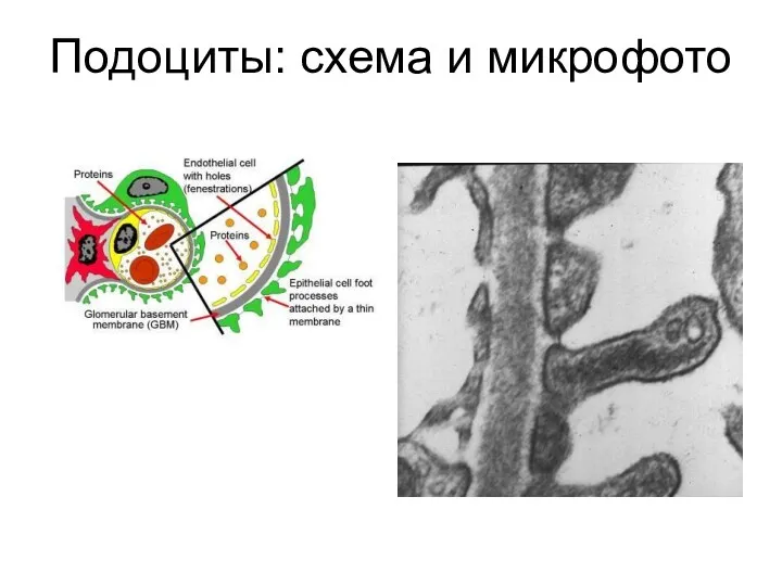 Подоциты: схема и микрофото