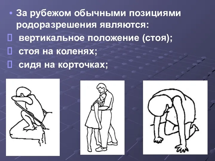 За рубежом обычными позициями родоразрешения являются: вертикальное положение (стоя); стоя на коленях; сидя на корточках;