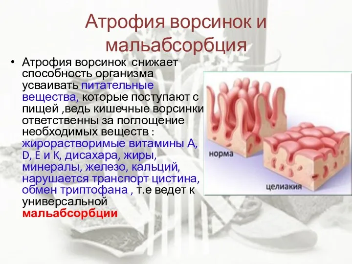 Атрофия ворсинок и мальабсорбция Атрофия ворсинок снижает способность организма усваивать