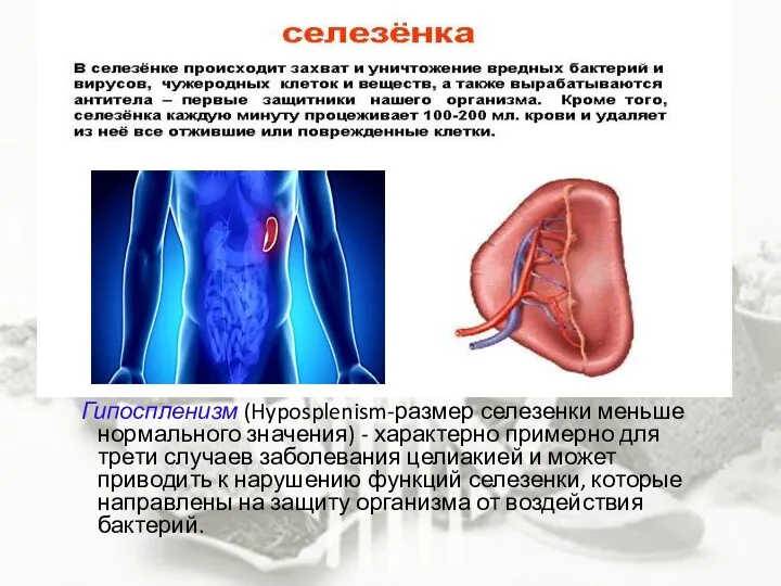 Гипоспленизм (Hyposplenism-размер селезенки меньше нормального значения) - характерно примерно для