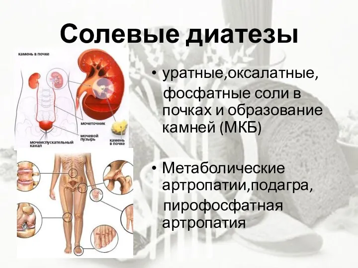 Солевые диатезы уратные,оксалатные, фосфатные соли в почках и образование камней (МКБ) Метаболические артропатии,подагра, пирофосфатная артропатия