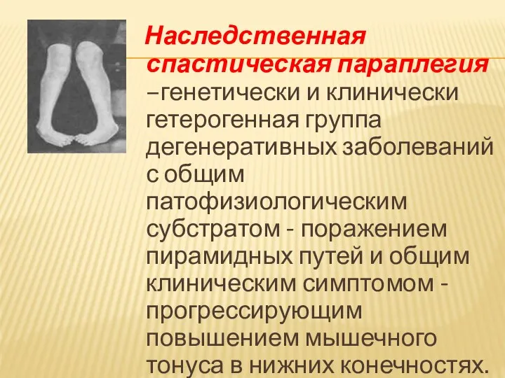 Наследственная спастическая параплегия –генетически и клинически гетерогенная группа дегенеративных заболеваний