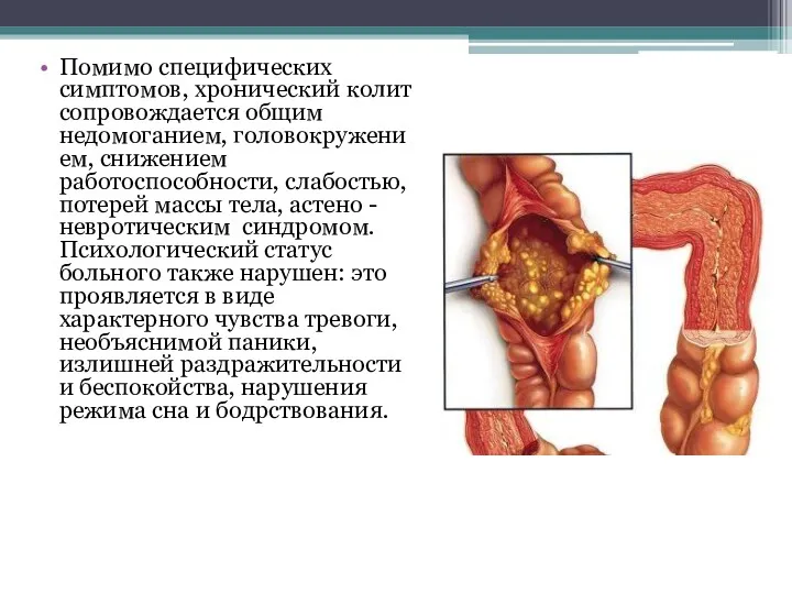 Помимо специфических симптомов, хронический колит сопровождается общим недомоганием, головокружением, снижением