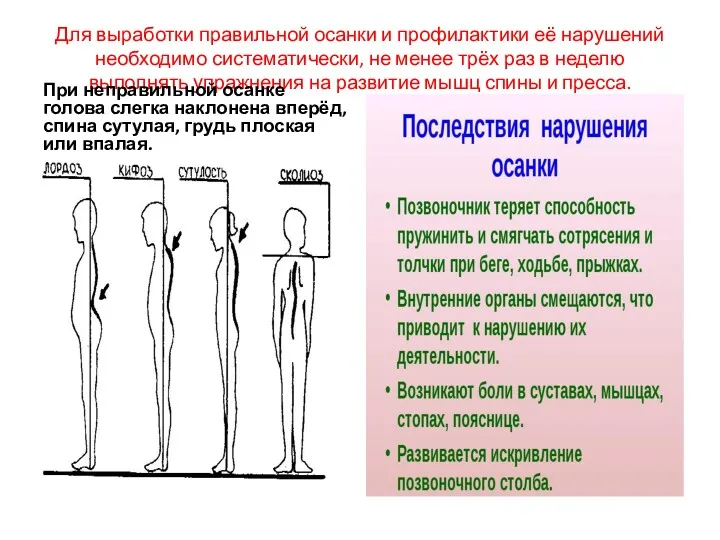 Для выработки правильной осанки и профилактики её нарушений необходимо систематически,