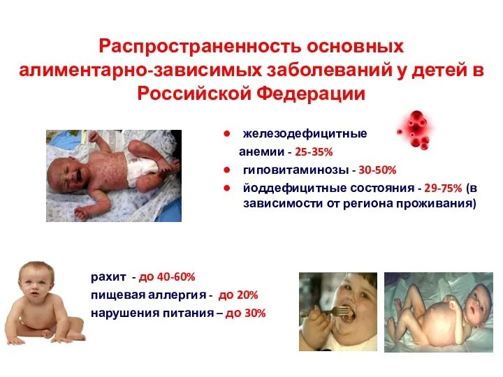 Распространенность основных алиментарно-зависимых заболеваний у детей в Российской Федерации железодефицитные
