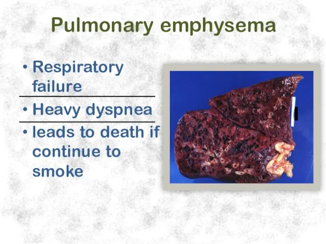 Pulmonary emphysema Respiratory failure Heavy dyspnea leads to death if continue to smoke
