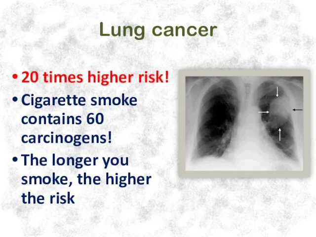 Lung cancer 20 times higher risk! Cigarette smoke contains 60 carcinogens! The longer