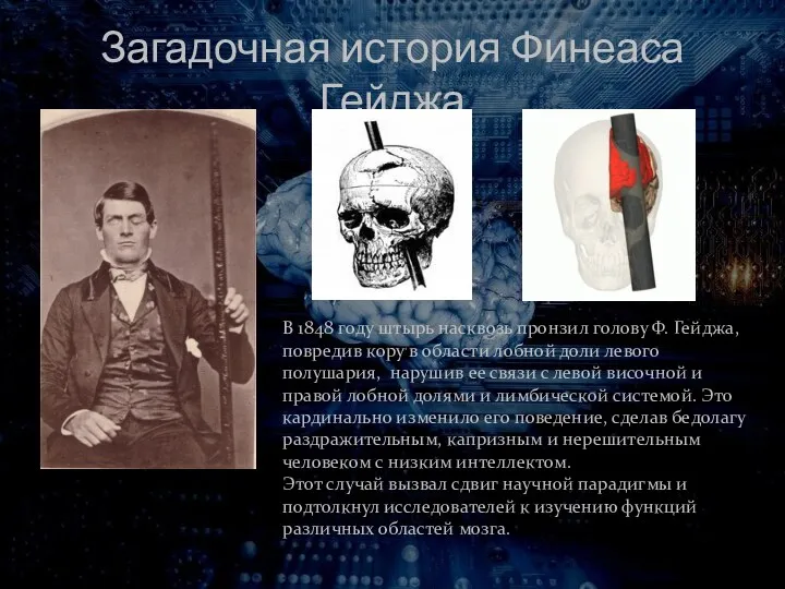 Загадочная история Финеаса Гейджа В 1848 году штырь насквозь пронзил