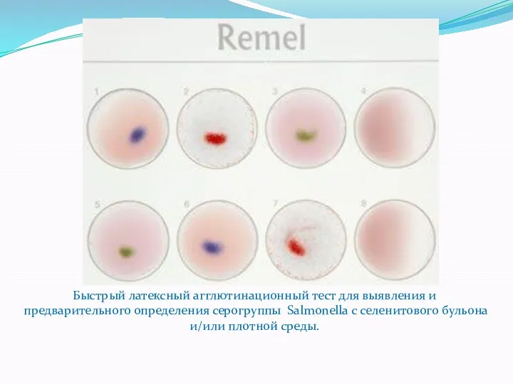 Быстрый латексный агглютинационный тест для выявления и предварительного определения серогруппы