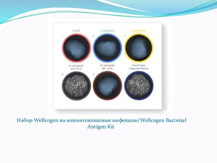 Набор Wellcogen на менингококковые инфекции/Wellcogen Bacterial Antigen Kit