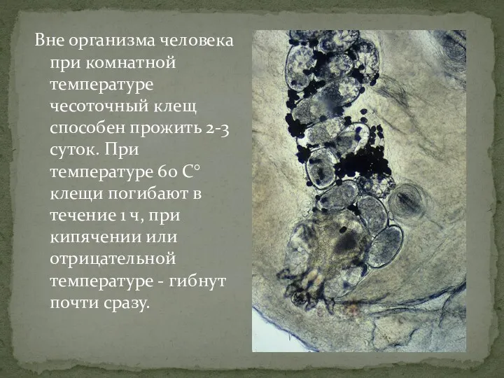 Вне организма человека при комнатной температуре чесоточный клещ способен прожить